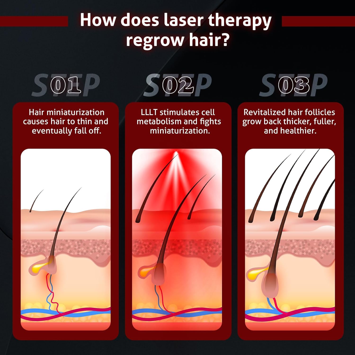 Kabellose Laserhaube zur Haarwiederherstellung – Rotlichttherapie