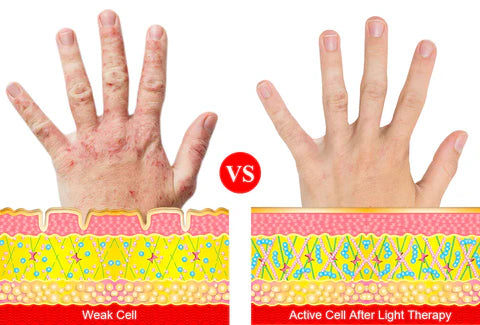 ArthroGlow Infrared Therapy Gloves For Arthritis Pain Relief